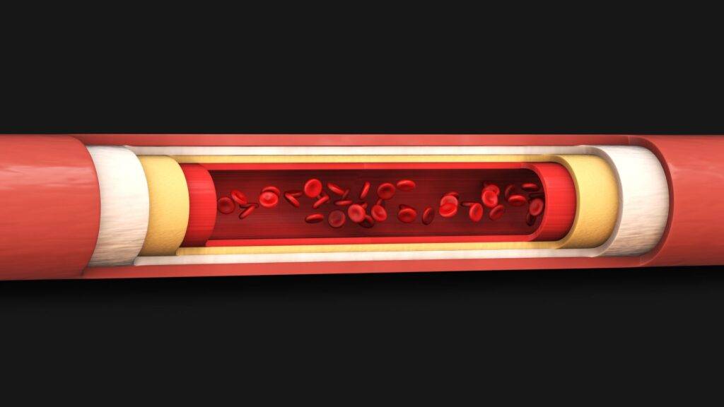 Gezeichnetes Gefäß und Blutzellen